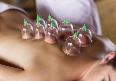 hijama